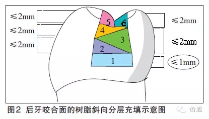 陳智：后牙復(fù)合樹脂修復(fù)技術(shù)概述