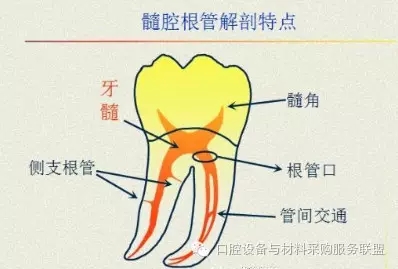 超實(shí)用的根管口的探查術(shù)