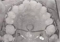 口腔醫(yī)學(xué)主治醫(yī)師筆試-精講強(qiáng)化-齲病牙體硬組織牙髓病和根尖周