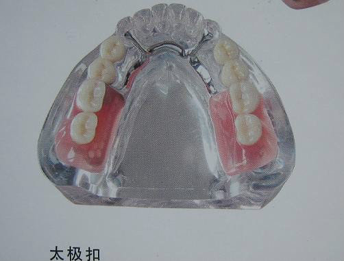 精密附件種類圖譜