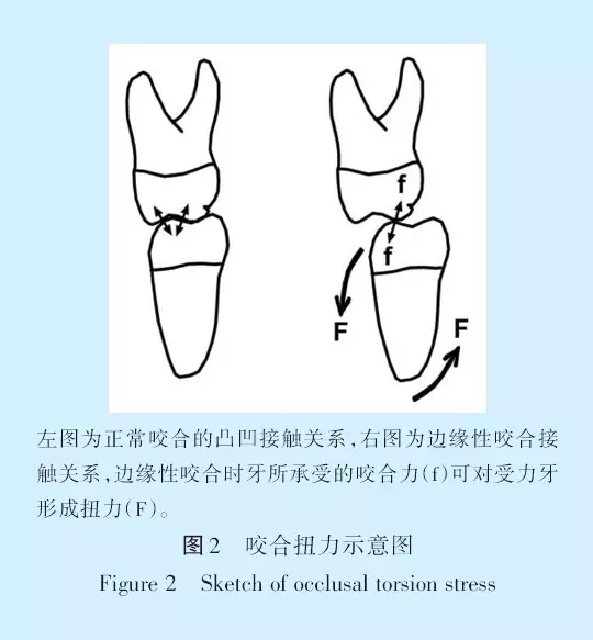 王美青.淺談咬合修復(fù)重建中的（牙合）學(xué)問(wèn)題