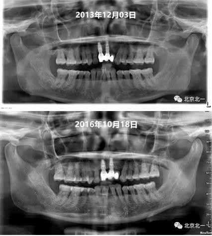 360截圖20170124115247233.jpg