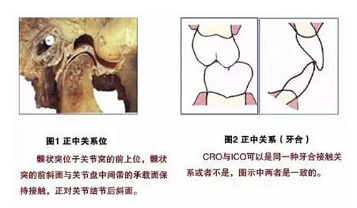 【臻美推薦】現(xiàn)代牙合學(xué)概念與全口固定義齒咬合重建