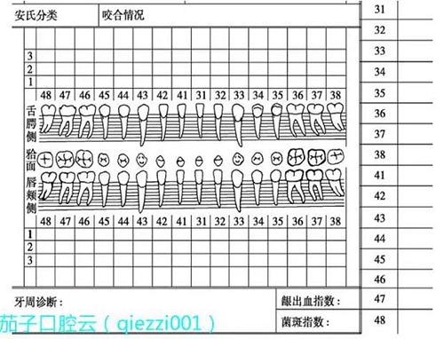 	口腔修復治療中，常見臨床接診流程