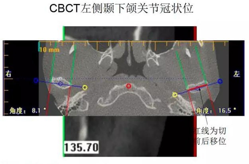 	口腔修復治療中，常見臨床接診流程