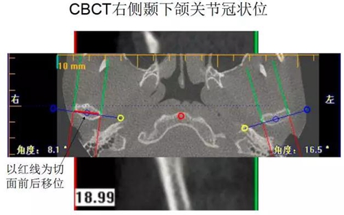 	口腔修復治療中，常見臨床接診流程