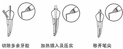 新熱熔充填系統(tǒng)C-Fill