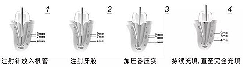 新熱熔充填系統(tǒng)C-Fill