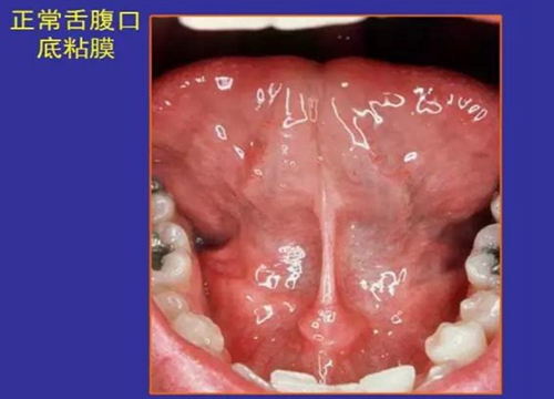 正?？谇火つぜ俺Ｒ姴p圖