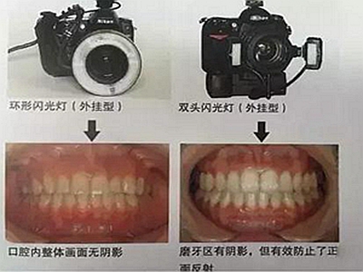 口腔攝影方法與技巧