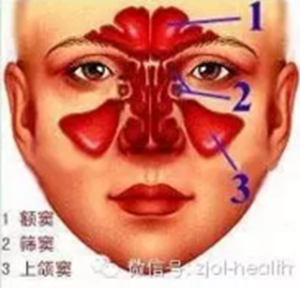 拔牙后引出“偏頭痛”！這種情況絕不能置之不理！