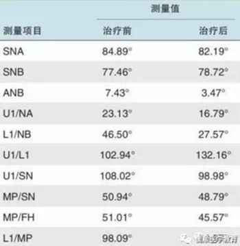 病例精選 | 骨性Ⅱ類高角面型矯治病例