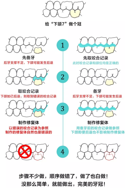 咬合記錄的對與錯