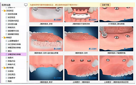 牙科普通前臺(tái)和優(yōu)秀前臺(tái)到底差在哪？