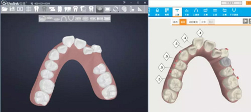 數(shù)字化技術(shù)應用于口腔正畸治療的思考