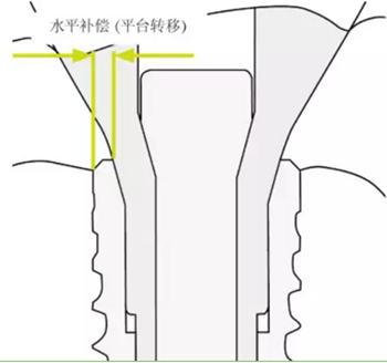 揭秘士卓曼種植體-基臺(tái)的長(zhǎng)期穩(wěn)定性