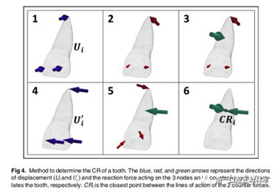 正畸文獻閱讀--對于滑動法關(guān)閉間隙的有限元分析