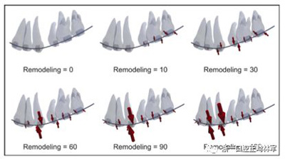 正畸文獻閱讀--對于滑動法關(guān)閉間隙的有限元分析