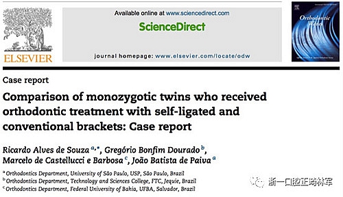 文獻(xiàn)優(yōu)秀正畸病例賞析--同卵雙胞胎使用自鎖托槽和傳統(tǒng)托槽正畸治療比較