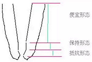 知識分享：根管治療的標(biāo)準(zhǔn)步驟