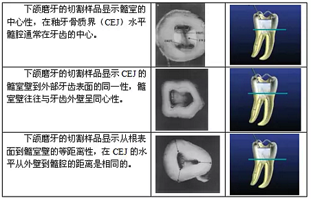 知識分享：根管治療的標(biāo)準(zhǔn)步驟