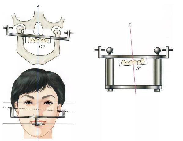 面弓實(shí)際應(yīng)用上的問題