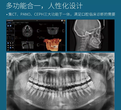 費(fèi)森影像