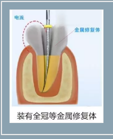 多頻技術(shù)的根管長度測定儀