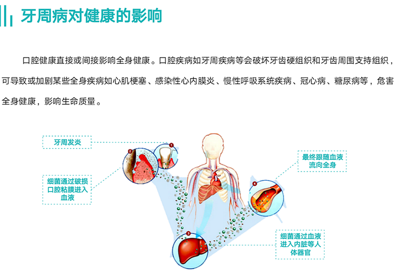 牙周病對(duì)健康的影響