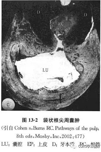 根尖周病的鑒別診斷