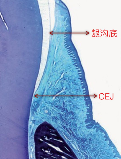 牙周解剖（一）：角化齦和附著齦爭(zhēng)議總結(jié)