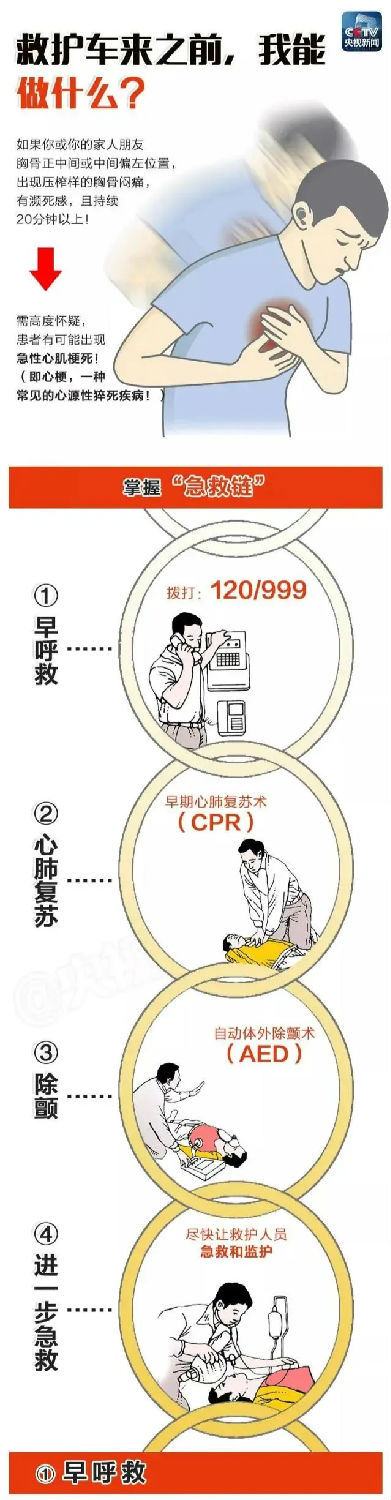 心肺復(fù)蘇