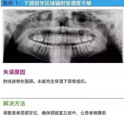 曲斷的10大經(jīng)典失誤案例及原因分析！