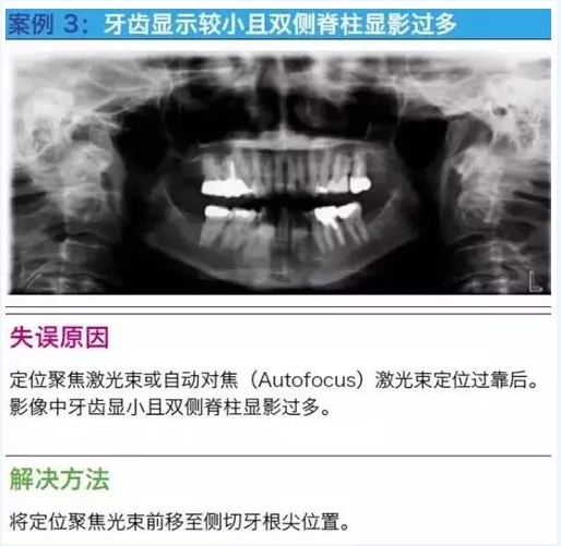 曲斷的10大經(jīng)典失誤案例及原因分析！