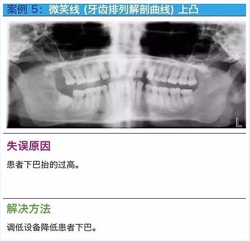 曲斷的10大經(jīng)典失誤案例及原因分析！