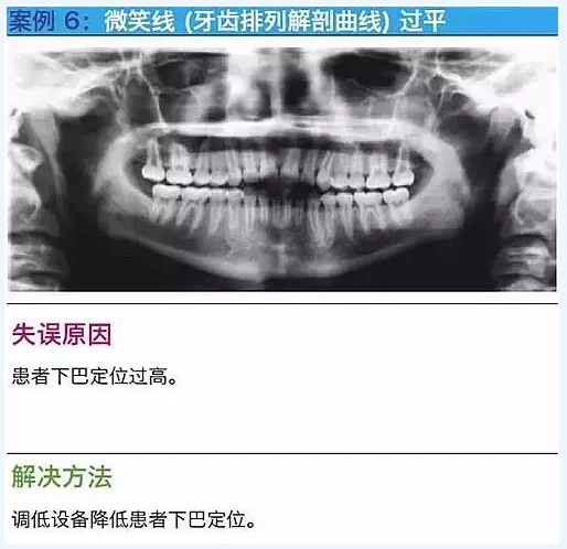 曲斷的10大經(jīng)典失誤案例及原因分析！