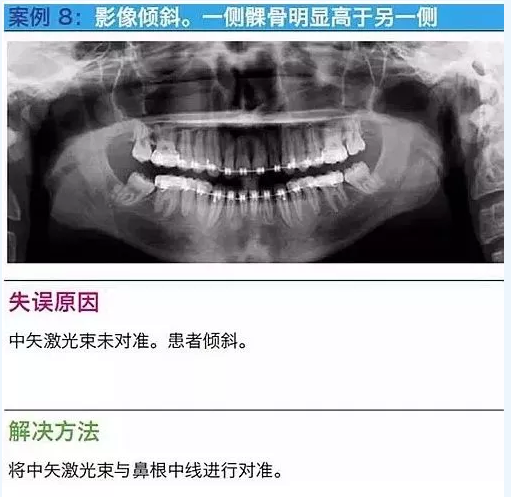 曲斷的10大經(jīng)典失誤案例及原因分析！