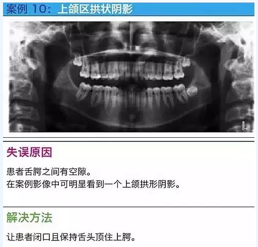 曲斷的10大經(jīng)典失誤案例及原因分析！