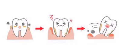 牙周病總是來(lái)勢(shì)洶洶？有辦法預(yù)防嗎？