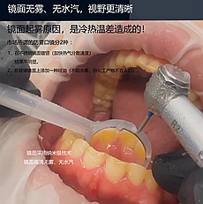 邦卡新型防霧吸水口鏡批發(fā)